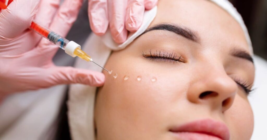 A woman receiving a PRP facial treatment, with a syringe being used to inject the serum into her skin.