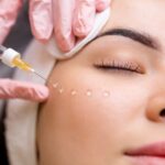 A woman receiving a PRP facial treatment, with a syringe being used to inject the serum into her skin.